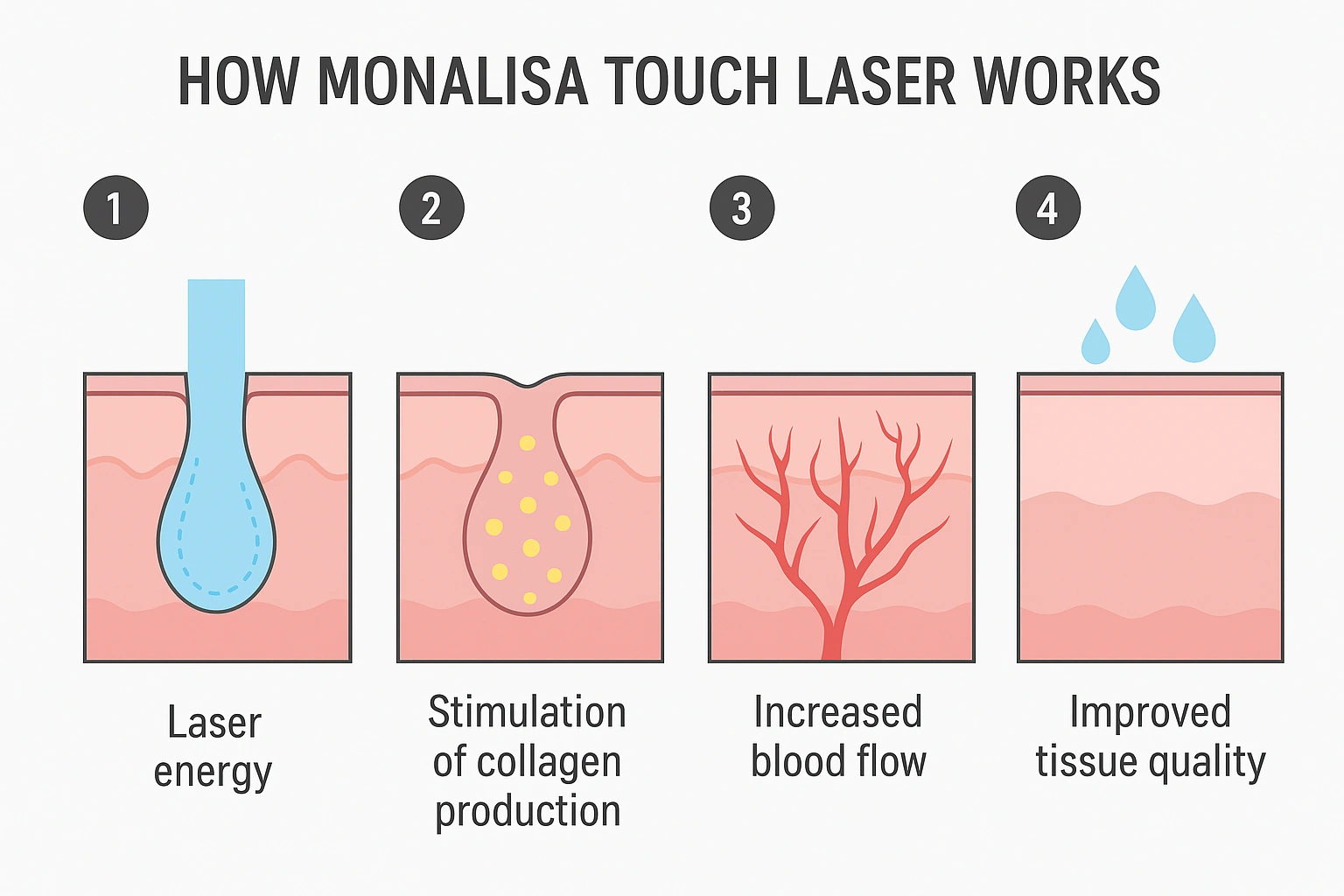 نحوه عملکرد لیزر مونالیزا