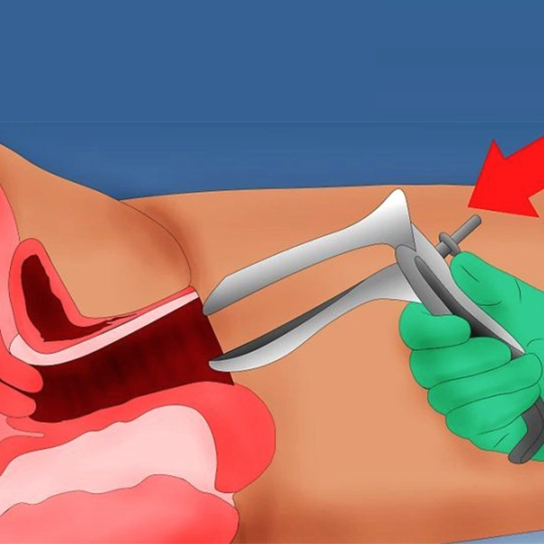 استفاده از اسپکتولوم