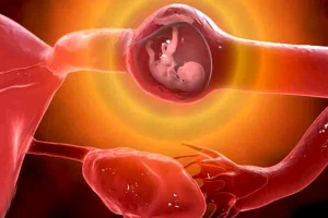 حاملگی خارج رحم، علائم و درمان