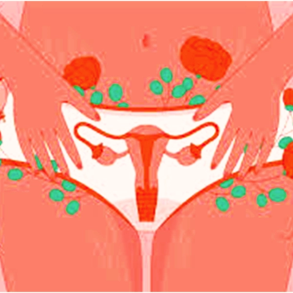 مراقبت‌های پس از درمان با نخ آپتوس واژینال