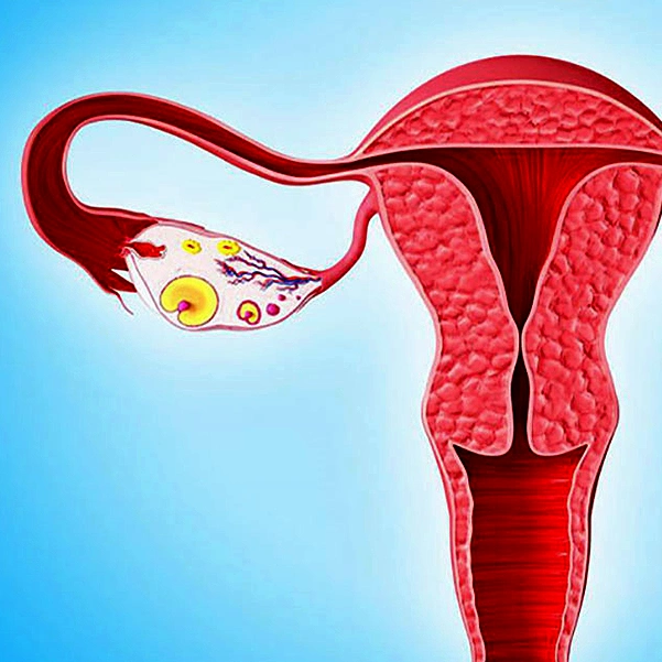 انواع مختلف سرطان رحم