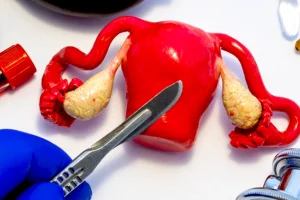 هیسترکتومی: جراحی برای برداشتن رحم