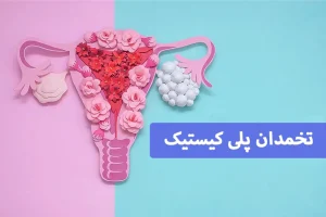 تنبلی تخمدان: تشخیص و درمان