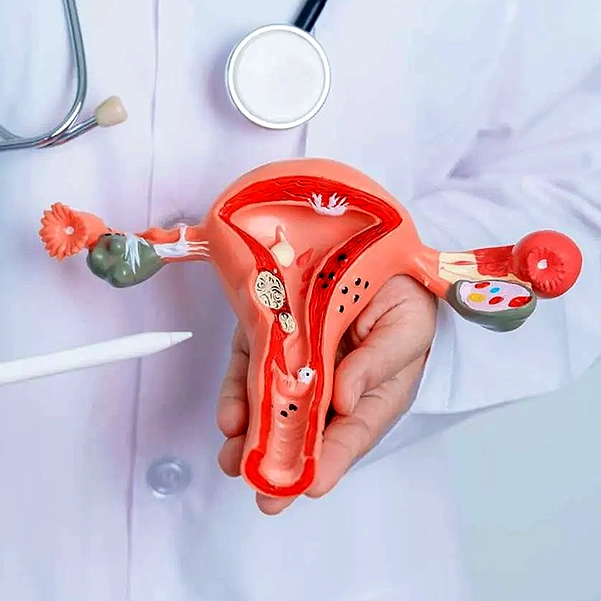 روش‌های درمان تنبلی تخمدان