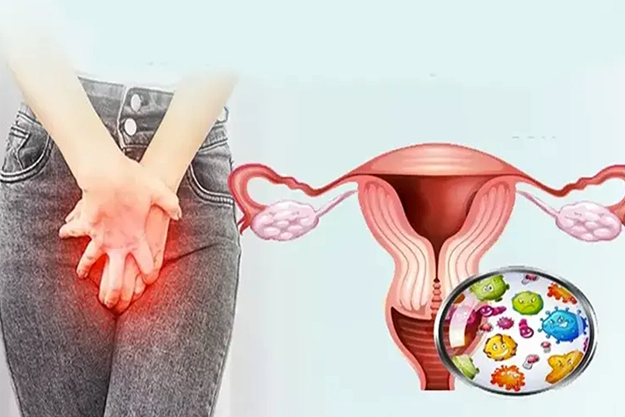 عفونت واژن، عوامل و درمان