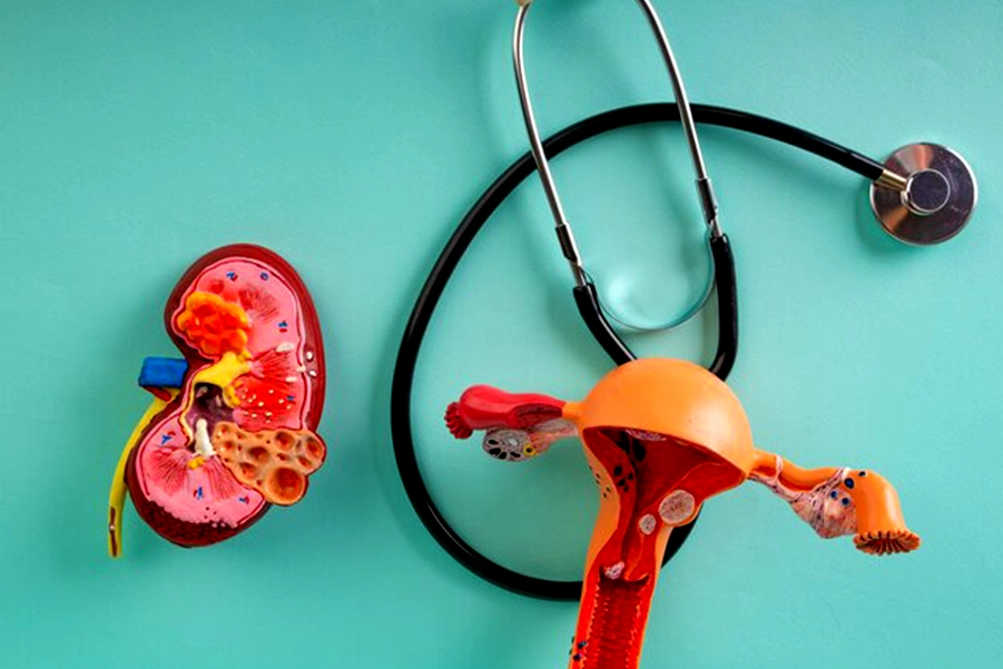 هیستروسکوپی