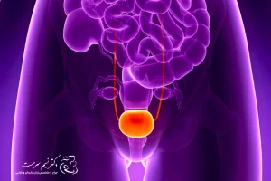 درمان عدم کنترل ادرار در بانوان