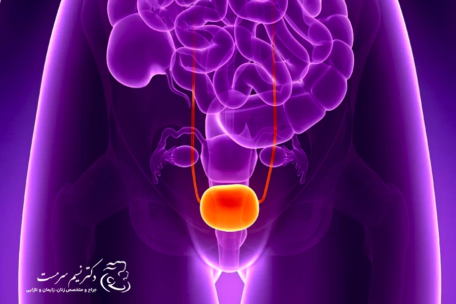 درمان عدم کنترل ادرار در بانوان