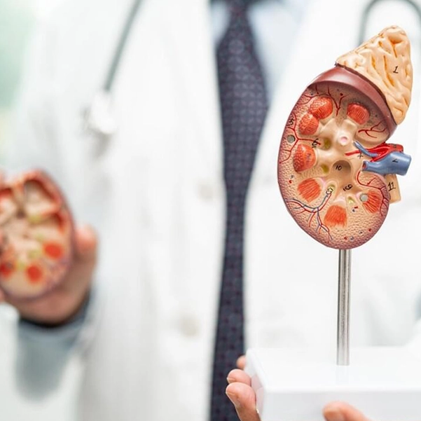 تشخیص عفونت کلیه