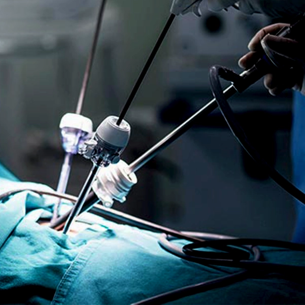 مراحل انجام لاپاراسکوپی