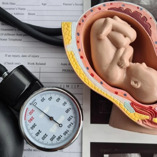 تأثیر دیابت بارداری بر حرکات جنین