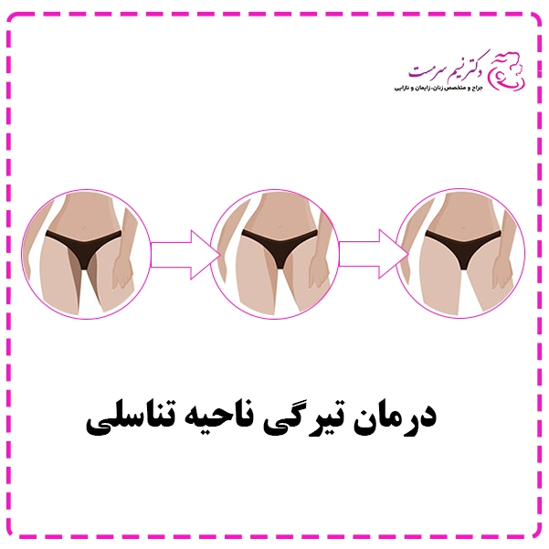 رفع تیرگی واژن
