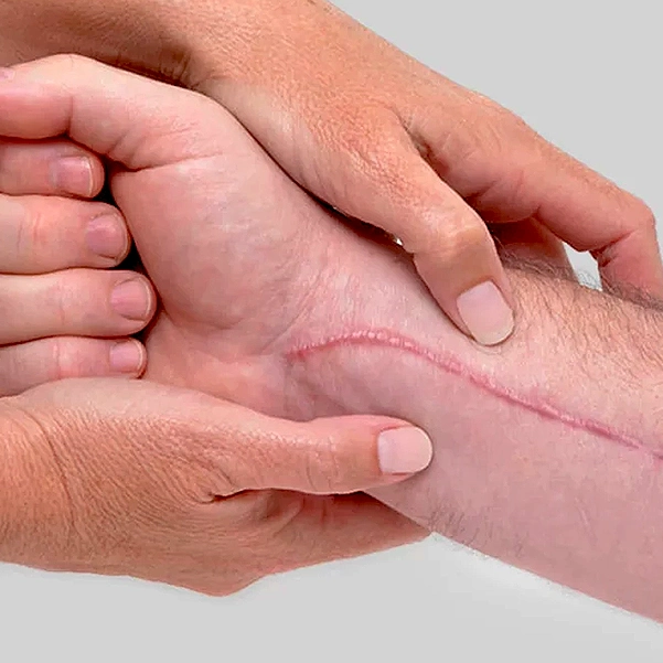 کلوئید چیست؟