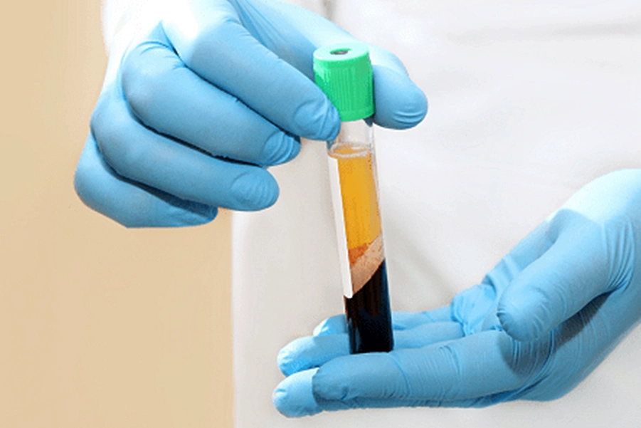 پلاسماتراپی، ماندگاری و کاربردها