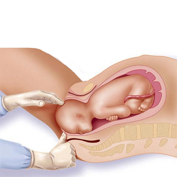 زایمان طبیعی چیست؟